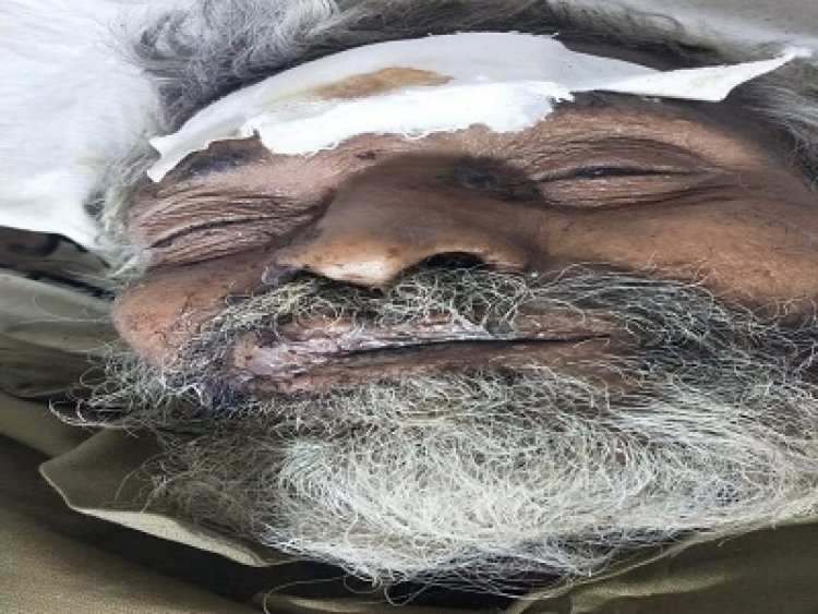 BIG NEWS: भाटखेड़ा चौराहे पर दुर्घटना में बुजुर्ग घायल, नीमच जिला अस्पताल में कराया भर्ती, उपचार के दौरान तोड़ा दम, अब POLICE को परिजनों की तलाश, अगर आपकों भी हो पहचान, तो करें इन नंबरों पर संपर्क, पढ़े खबर