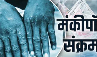 BIG BREAKING: कोरोना के बढ़ते मामले, अब मंकी पॉक्स को लेकर सरकार ने जारी किया अलर्ट, जाने MP में क्या है स्थिति, पढ़े खबर