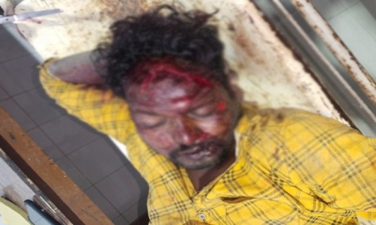 OMG ! बाइक पर सवार नलखेड़ा का अर्जुन, ग्राम बर्डिया पहुंचते ही हुआ ये हादसा, सिर में आई चोट, तो हालत गंभीर, उपचार के बाद मनासा से जिला अस्पताल रैफर, पढ़े मनीष जोलान्या की खबर