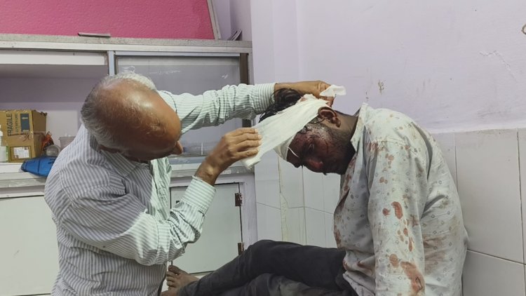 NEWS: दो भाईयों में इस बात पर विवाद, चले जमकर पत्थर, एक युवक गंभीर घायल, मनासा पुलिस जांच में जुटी, पढ़े खबर
