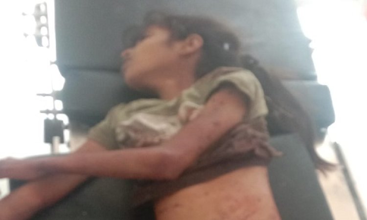 OMG ! खेत में खेलती बच्ची, अचानक आएं आवारा कुत्ते, और कर दिया हमला, मासूम की अकाल मौत, मामला मंदसौर जिले का, पढ़े खबर