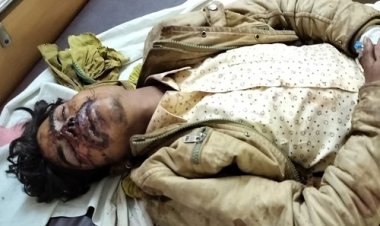 NEWS : महुड़िया गांव के पास सड़क हादसा, एक व्यक्ति गंभीर घायल, पहचान सुनील के रूप में, अगर आपको है कोई जानकारी, तो नीमच जिला अस्पताल में करें संपर्क, पढ़े खबर