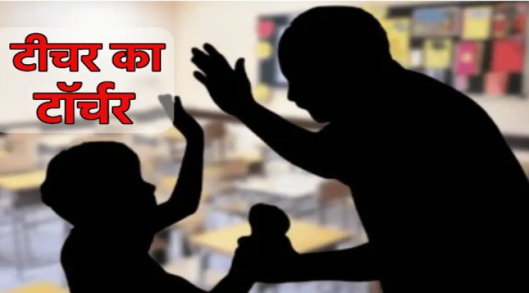 OMG ! MP में छात्र को मिली तालिबानी सजा, उखाड़ दिए बाल, तो हो गए जख्म, शिक्षक कैसे बना हैवान, और क्या होगी कार्यवाही, पढ़े खबर