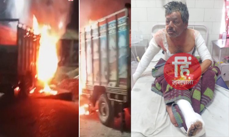 BIG BREAKING : आगजनी में झुलसे भगतराम की दर्दनाक मौत, उपचार के दौरान तोड़ा दम, मामला नीमच मंडी में खड़ी पिकअप में लगी भीषण आग का, पढ़े खबर