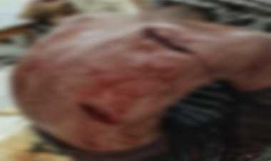 BIG NEWS : आपसी विवाद में हुआ बवाल, खुलेआम चले धारदार हथियार, घटना में रमेश हुआ गंभीर घायल, उपचार के बाद जिला अस्पताल रैफर, मामला कुकड़ेश्वर थाना क्षेत्र के इस गांव का, पुलिस जुटी जांच में, पढ़े खबर