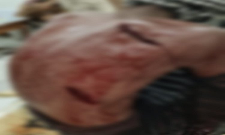 BIG NEWS : आपसी विवाद में हुआ बवाल, खुलेआम चले धारदार हथियार, घटना में रमेश हुआ गंभीर घायल, उपचार के बाद जिला अस्पताल रैफर, मामला कुकड़ेश्वर थाना क्षेत्र के इस गांव का, पुलिस जुटी जांच में, पढ़े खबर