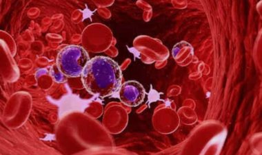 NEWS: महिला दिवस पर नीमच में स्वास्थ्य जागरूकता की अनोखी पहल,कैंसर-थैलेसीमिया के खिलाफ 8 मार्च को सड़कों पर दौड़ेगी कार रैली, पढ़े खबर