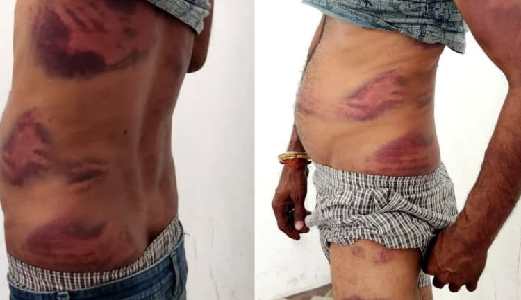 BREAKING NEWS : एथेनॉल कम आया… तो ड्राइवर पर टूटा कहर,900 लीटर के विवाद ने लिया हिंसक रूप, ऑफिस में हुई पाइप से पिटाई, पिपलियामंडी निवासी आर्यन अग्रवाल समेत तीन पर मामला दर्ज, पढ़े खबर